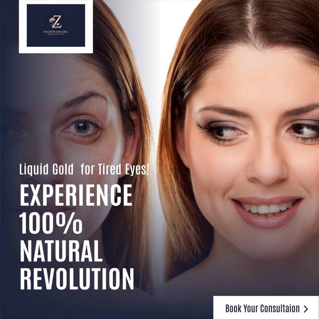 PRF Under-Eye 'Liquid Gold' for tired eyes — 100% natural platelet-rich fibrin for tear troughs at Maison Zolara, Lansing MI
