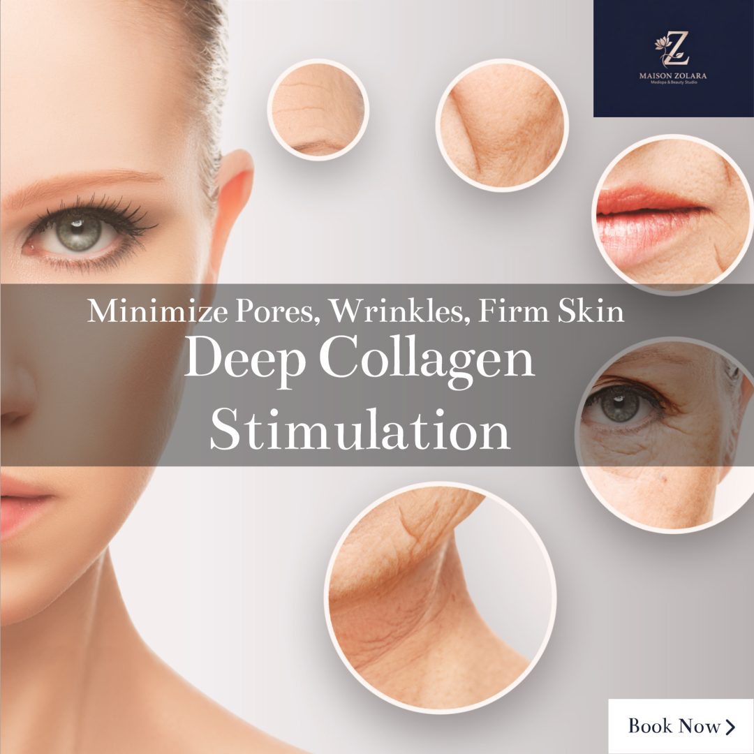 Microneedling treatment for acne scars Lansing medspa