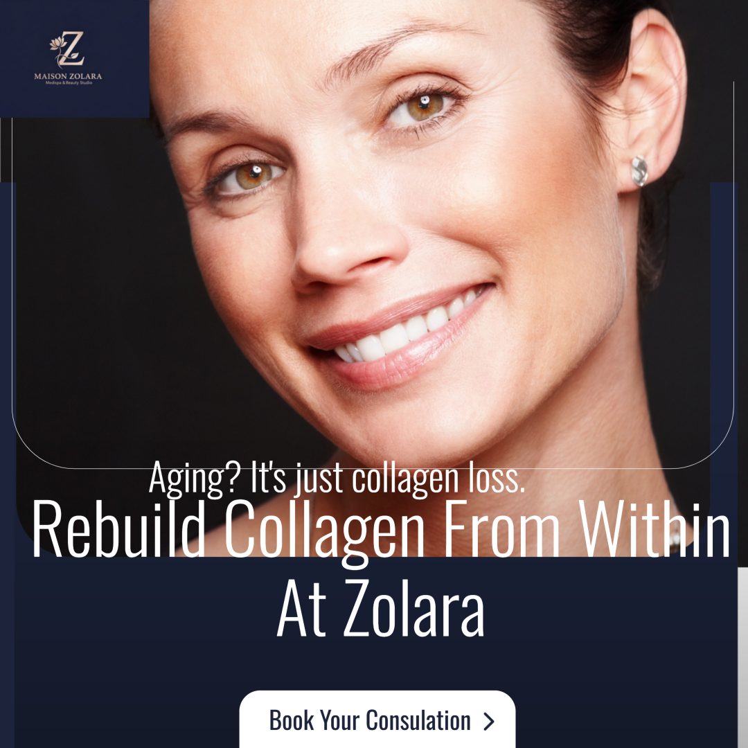 Sculptra collagen-stimulating biostimulator — rebuild collagen from within at Maison Zolara, Lansing MI